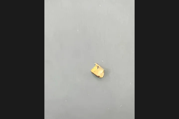 金歯 0.4g